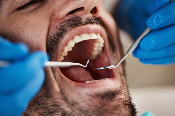 Professional Emergency Dental Service in IN