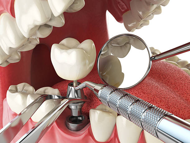 Best Weekend Emergency Dental Services in Culver, IN