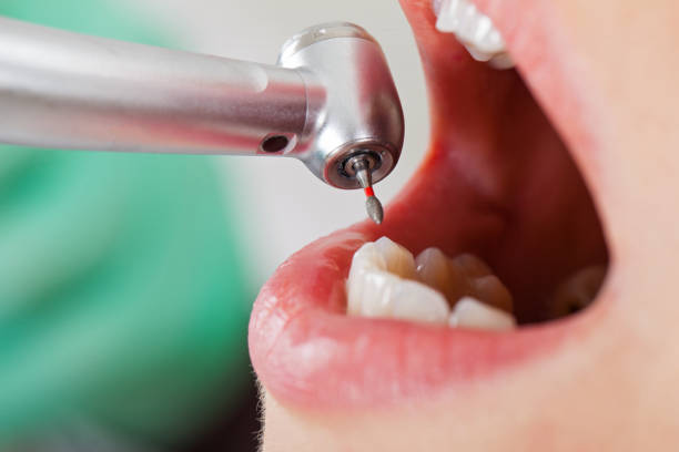 Best Emergency Treatment for Jaw Pain or Injury in Culver, IN